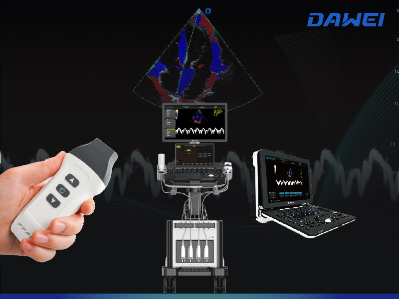 Breakthrough in Motion and Blood Flow Imaging اختراق في تصوير الحركة وتدفق الدم