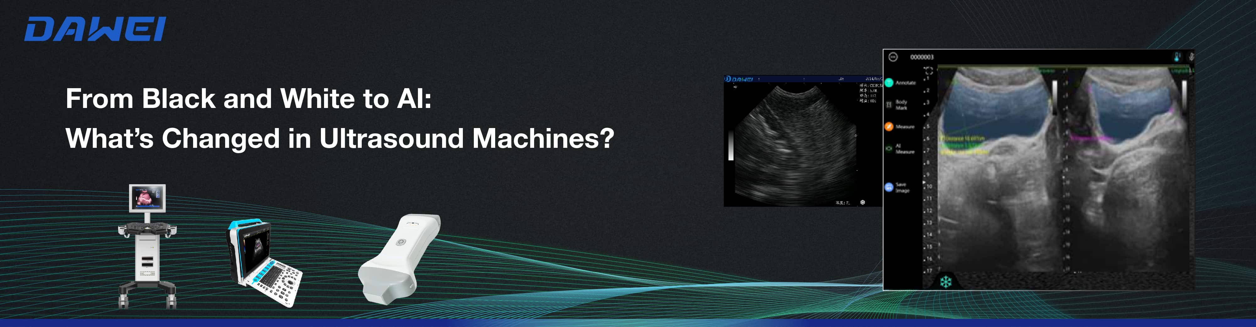 From Black and White to AI What’s Changed in Ultrasound Machines من الأبيض والأسود إلى الذكاء الاصطناعي: ما الذي تغير في أجهزة الموجات فوق الصوتية؟