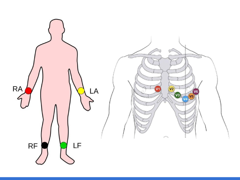 مكونات مفتاح وضع ECG Electrode