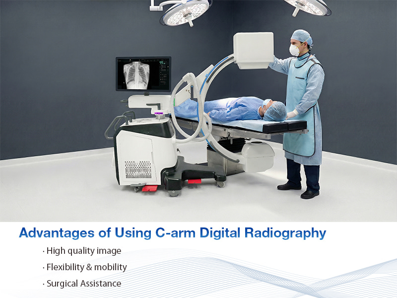 مميزات استخدام التصوير الشعاعي الرقمي C-arm