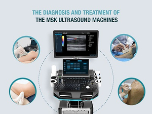 MSK Ultrasound Machines.jpg