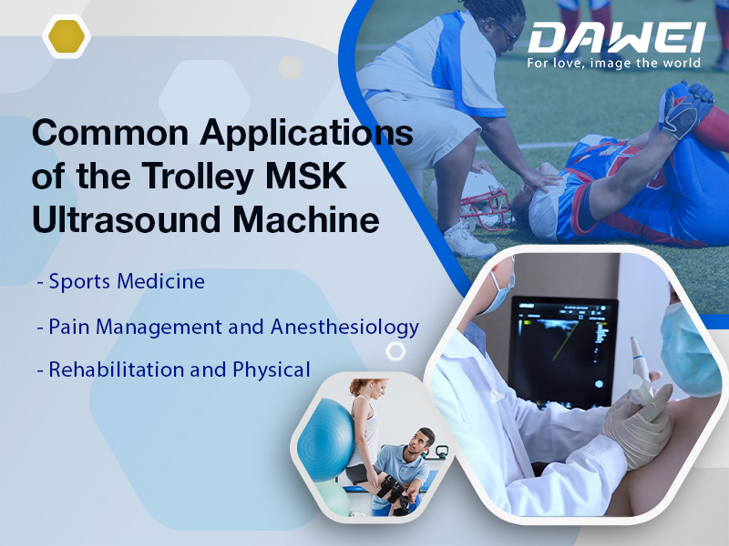 Enhancing Musculoskeletal Diagnostics with The Trolley MSK Ultrasound Machine-800-600.jpg