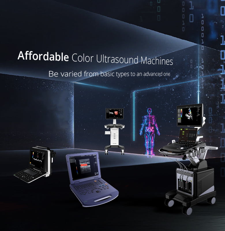 affordable ultrasound machine