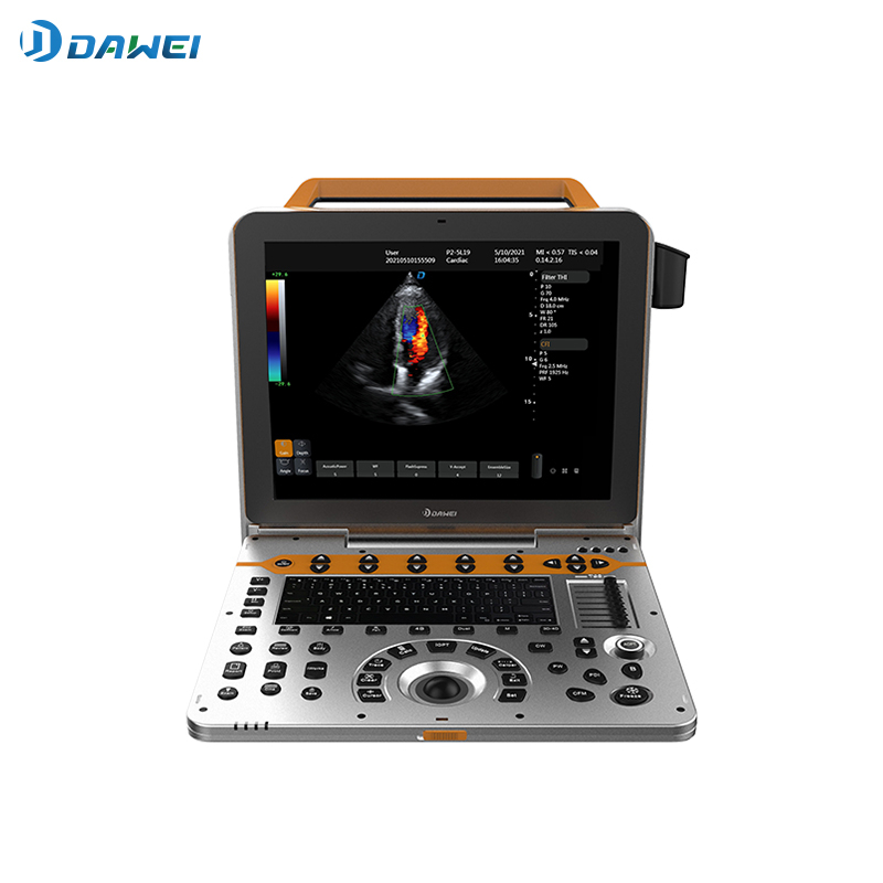 جهاز الموجات فوق الصوتية دوبلر الملون المحمول ثلاثي الأبعاد ورباعي الأبعاد
