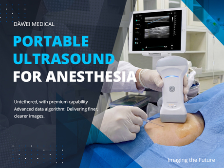 Portable Ultrasound for Anesthesia.jpg