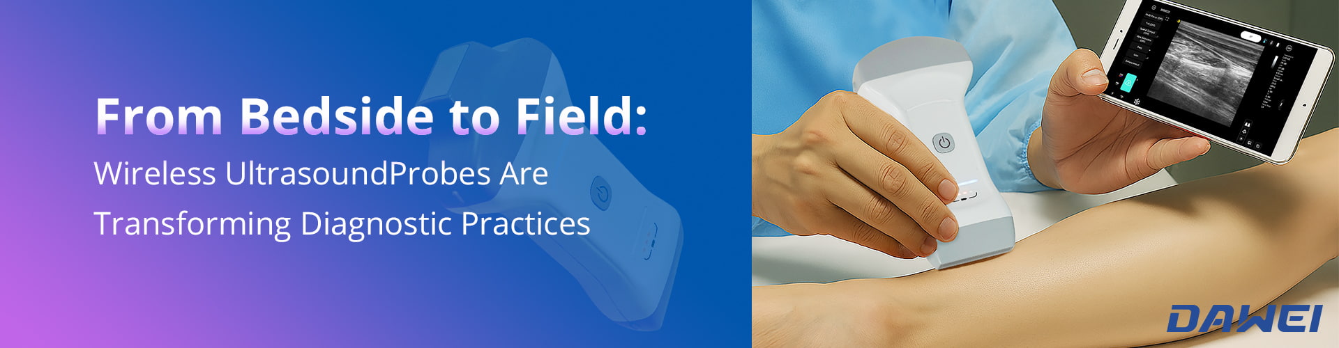 من السرير إلى الميدان: كيف تعمل مجسات الموجات فوق الصوتية 