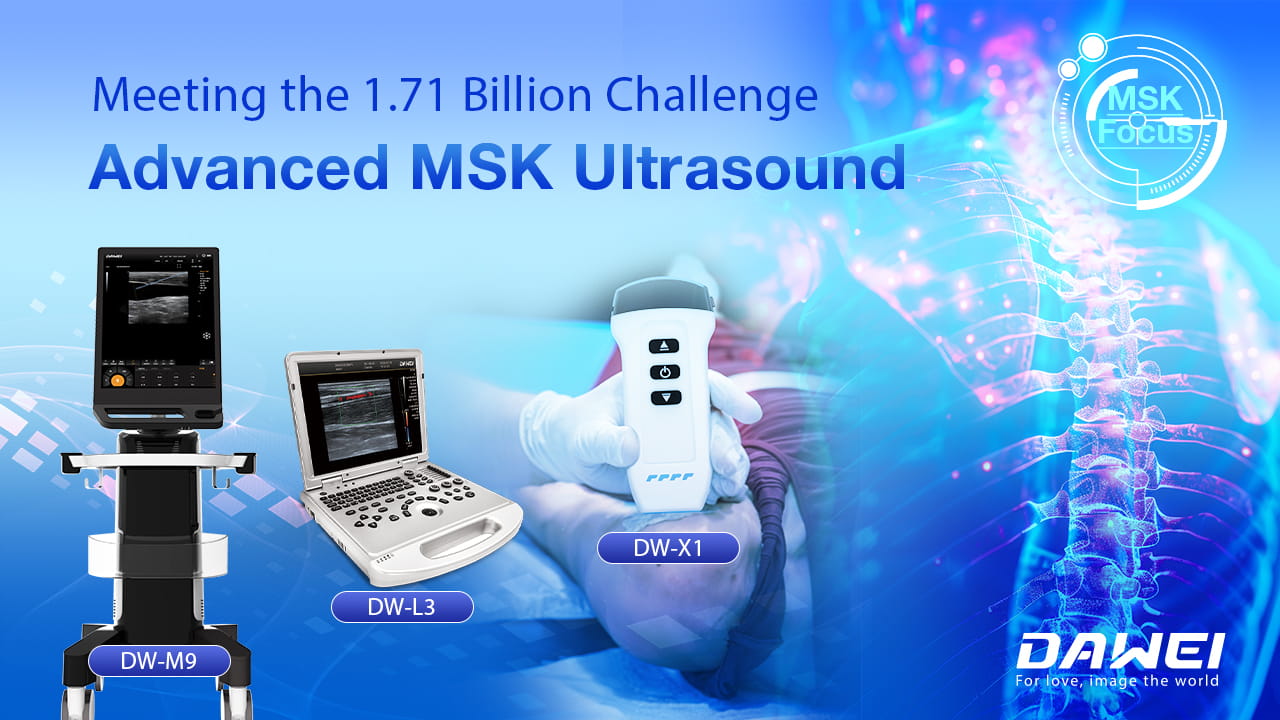 تلبية 1.71 مليار التحدي المتقدم MSK الموجات فوق الصوتية