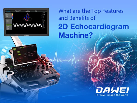 The Best 2D Echocardiogram Machines What are the Top Features and Benefits of Accurate Heart Diagnostics800-600.jpg