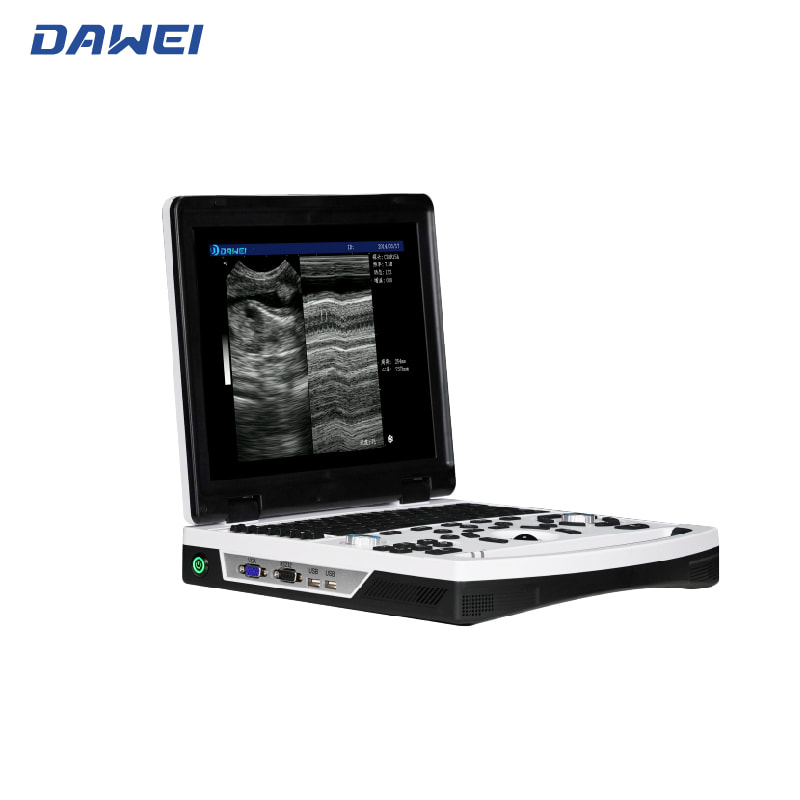 نظام التشخيص بالموجات فوق الصوتية المحمولة