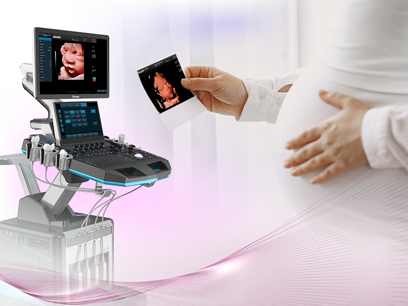 241024What’s the Difference between 3D and 4D Ultrasound Scanning.jpg