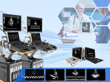 How The Heart Ultrasound Machine Works And Why It’s Essential for Cardiac Care-800-600.jpg